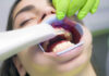 Aparaty ortodontyczne najlepszej jakości