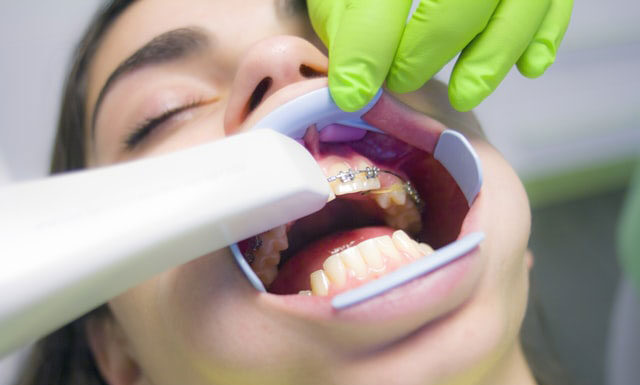 Aparaty ortodontyczne najlepszej jakości